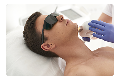 laser ontharen gezichtshaar