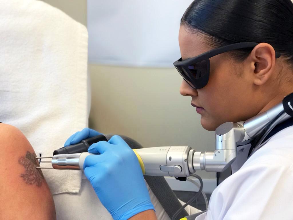 Tattoo Verwijderen Kosten TB Medical