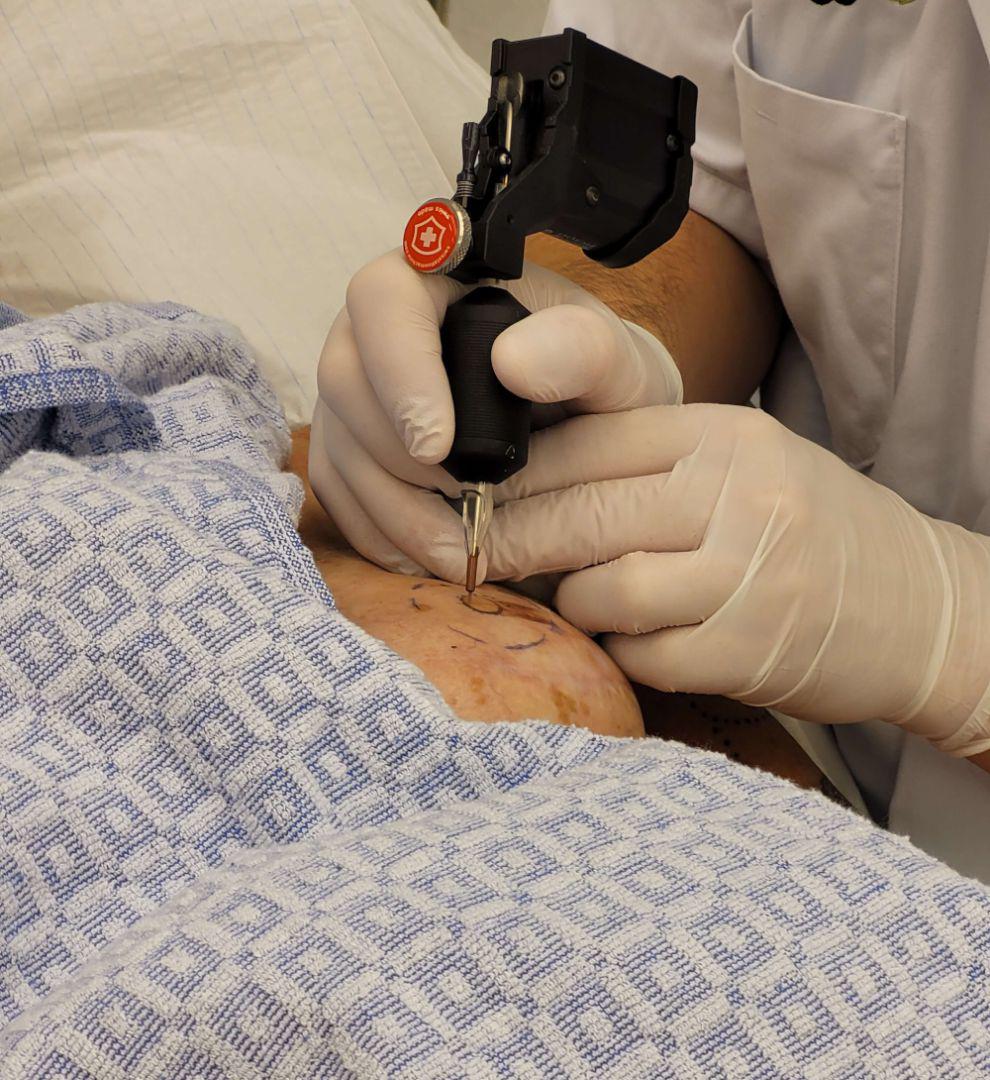 Tepelhof reconstructie