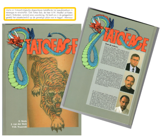 Tatoeage verwijderen in het boek Tatoeage