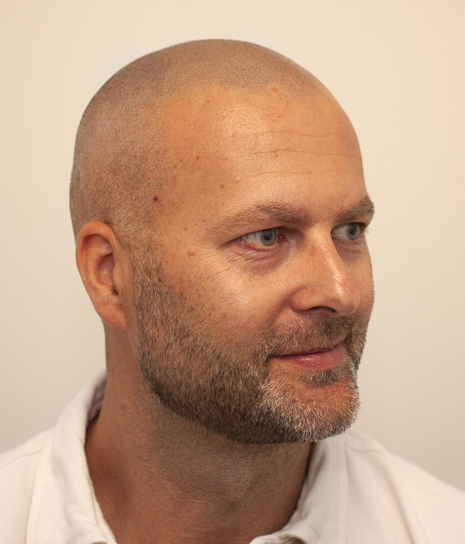www.microhaarpigmentatie.nl