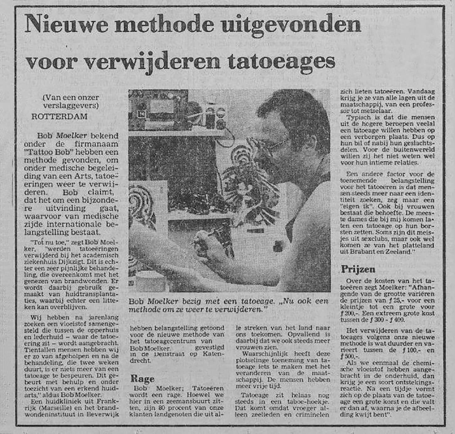 tatoeage verwijderen historie