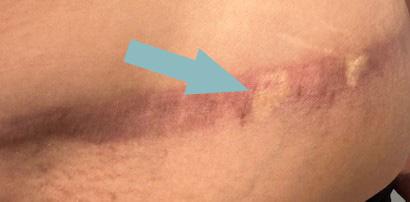 Proefstukje medische pigmentatie